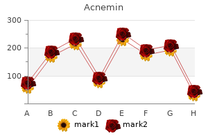discount acnemin online master card