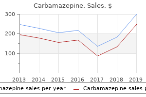 order carbamazepine 200 mg free shipping