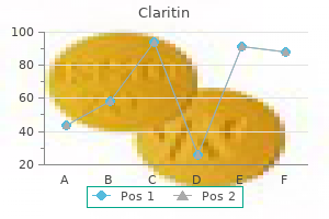 buy claritin with mastercard