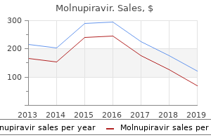 cost of molnupiravir