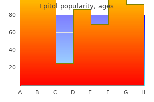 purchase epitol 100 mg without prescription