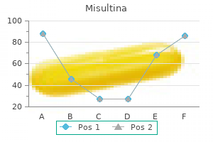 purchase on line misultina