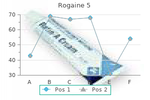 generic rogaine 5 60ml