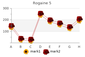 buy cheapest rogaine 5 and rogaine 5