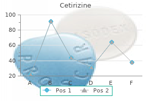 order cetirizine 5mg visa